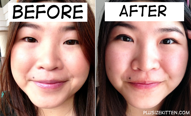 difference between single eyelid and double eyelid