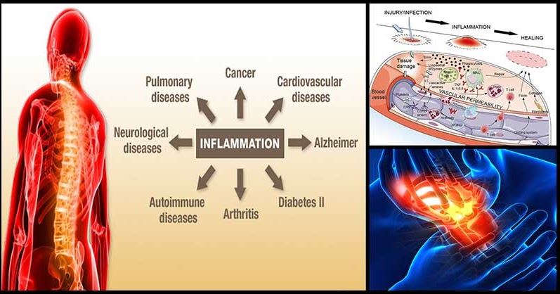 Proven Natural Ways To Fight Inflammation Dr. Farrah MD