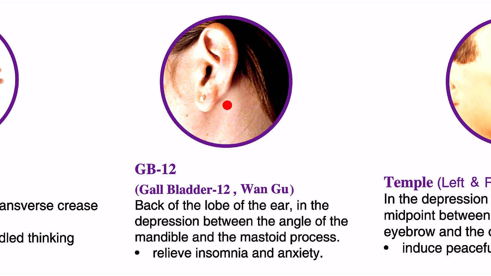 Acupuncture Points For Insomnia Insomnia Choices