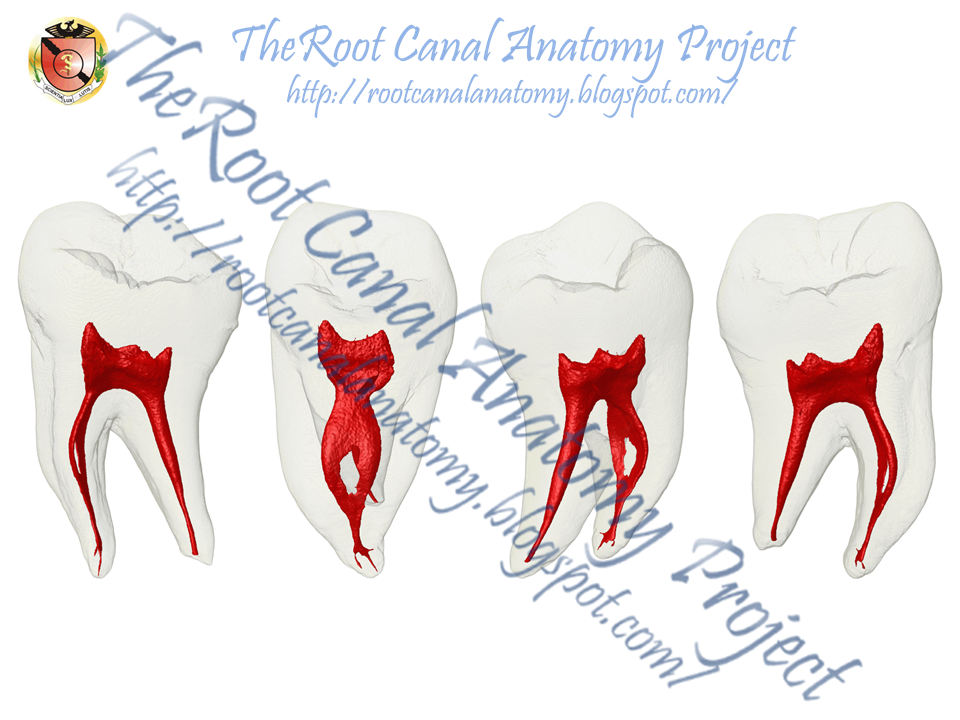 The root canal anatomy project mandibular first molar