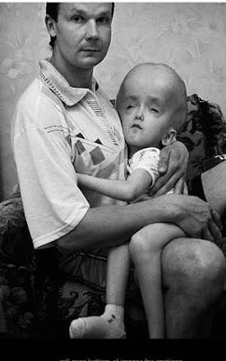 Crisis Pictures: The Chernobyl nuclear disaster - part II