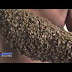 Man's Hands Covered By Bees After He Stole A Car From The Owner compound.