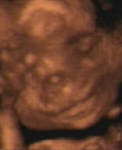 Hafta hafta bebeğin ultrason görüntüleri-19.hafta
