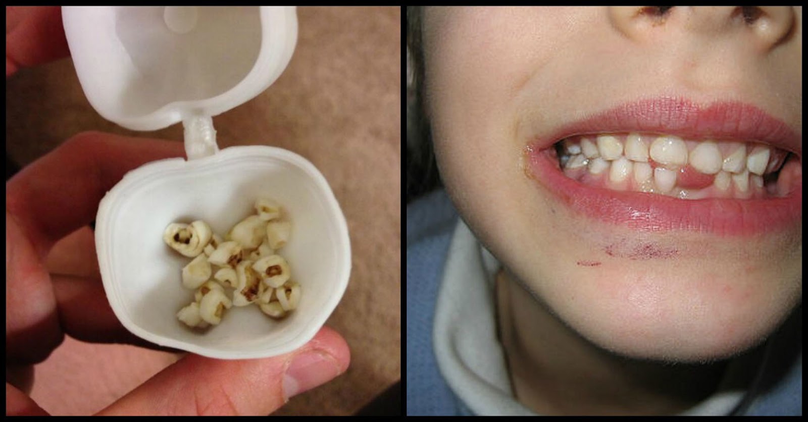 Doctors Are Urging Parents Everywhere To Keep Their Kids’ Baby Teeth