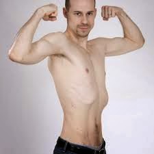 Upset U thinness Weight increase-दुबलेपन से परेसान है तो वजन बढ़ाये Weight increase