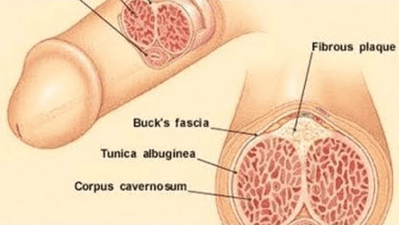 Here's How Excessive Masturbation Can Affect Your Health And Sexual Life Here's How Excessive Masturbation Can Affect Your Health And Sexual Life