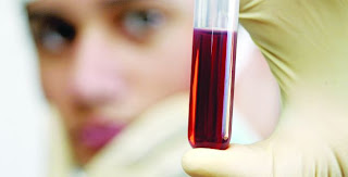 Ρουμάνοι επίστημονες κατάφεραν να δημιουργήσουν τεχνητό αίμα!
