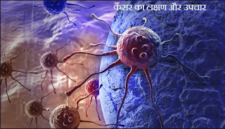 cancer ka lakshan or ayurvedic ilaj, iski roktham, ब्लड  कैंसर की रोकथाम और सावधानियाँ और घरेलु इलाज 