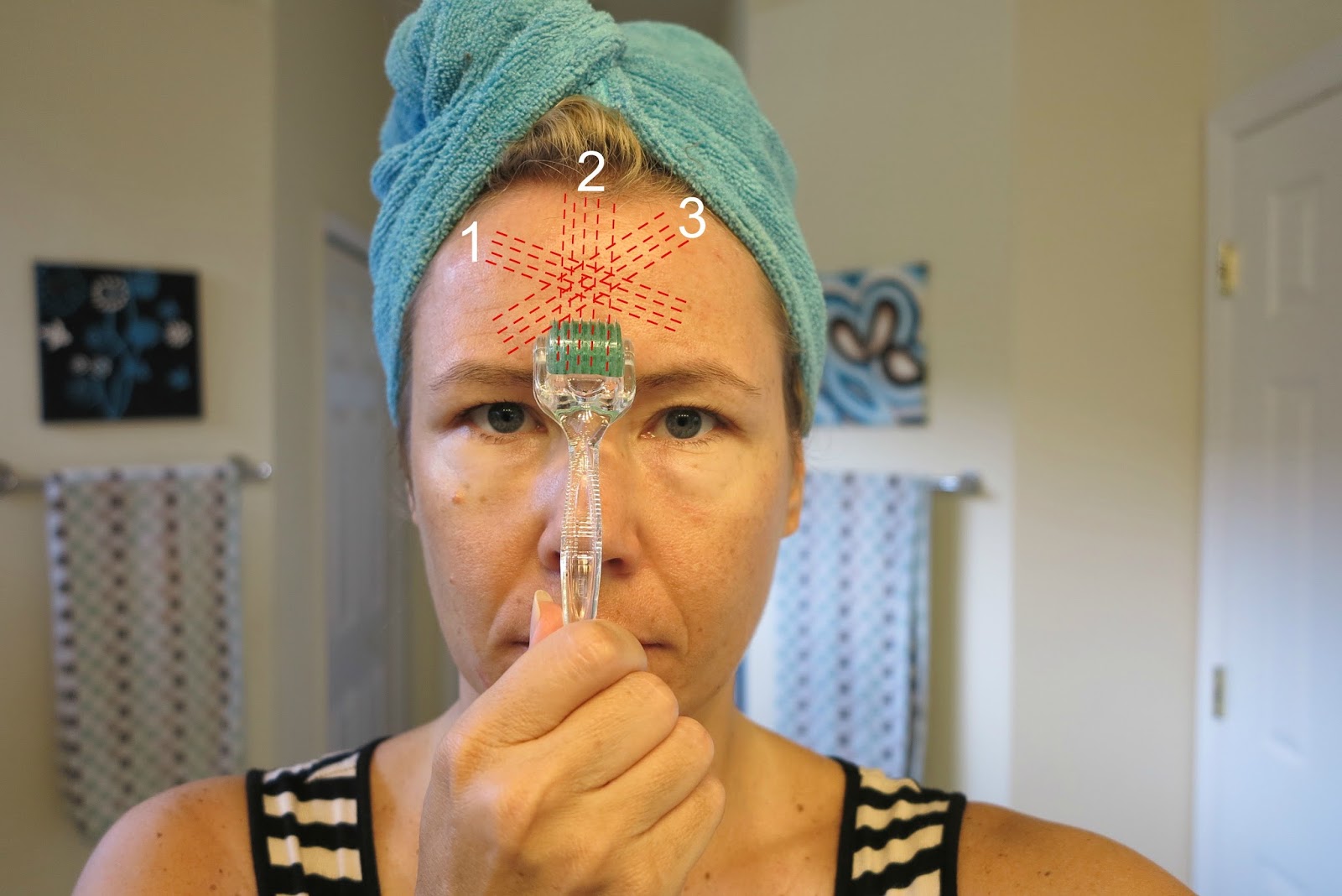 DERMAROLLER 1 YEAR UPDATE DOES THIS WORK?