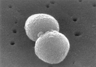 Micrografía de la bacteria que ocasiona la neumonia (Streptococcus penumoniae)