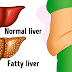 6 Warning Signs Your Liver Is Full of Toxins And Making You Fat