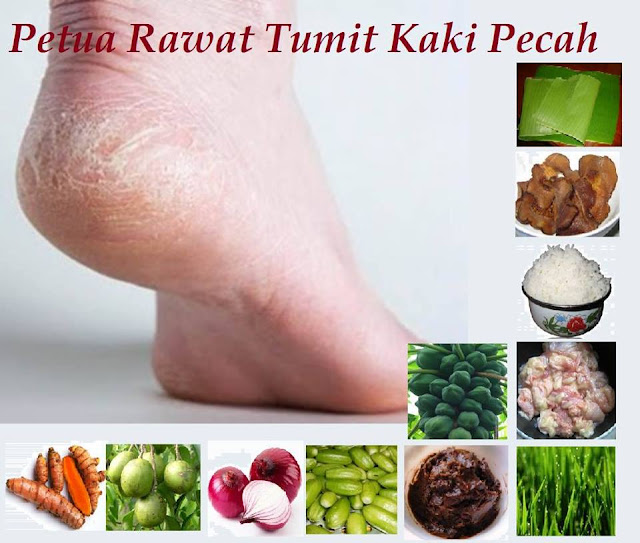 Petua Lembapkan Tumit Kaki Dengan Minyak Almond Petua Lembapkan Tumit Kaki Dengan Minyak Almond