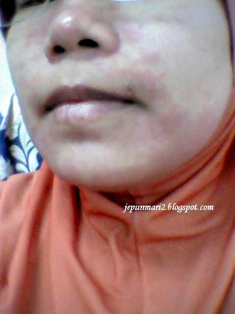 allergic makan
