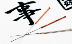 Acupuntura para adelgazar zona sur