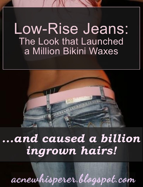 Low rise jeans, the look that launched a million bikini waxes