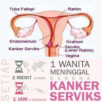 https://2.bp.blogspot.com/-4OkObT2dHGQ/WNTZJJka96I/AAAAAAAAAaY/YjGIdZ1a70Q6saU4R9848YiJON4Yxz5yACLcB/s1600/kanker%2Bserviks.jpg