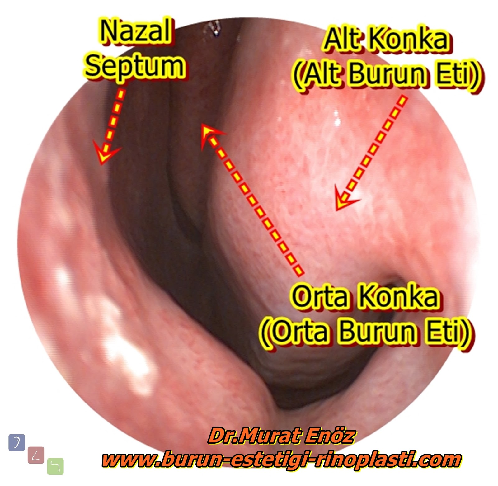 Burun Etleri (Konkalar) İle İlgili Farklı Bilgiler