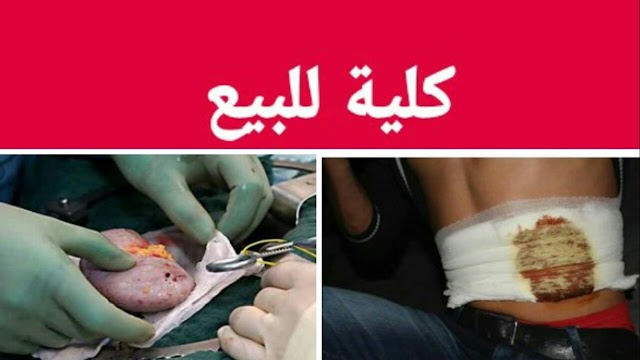 ابن شهيد حرب الصحراء يعرض كليته للبيع ،لتوفير العلاج لامه 