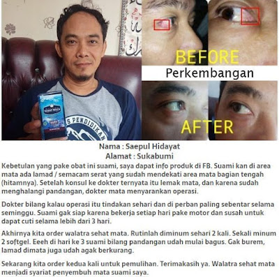 Cara Mengatasi Penglihatan Buram, Kabur Dan Berbayang Secara Alami Cara Mengatasi Penglihatan Buram, Kabur Dan Berbayang Secara Alami