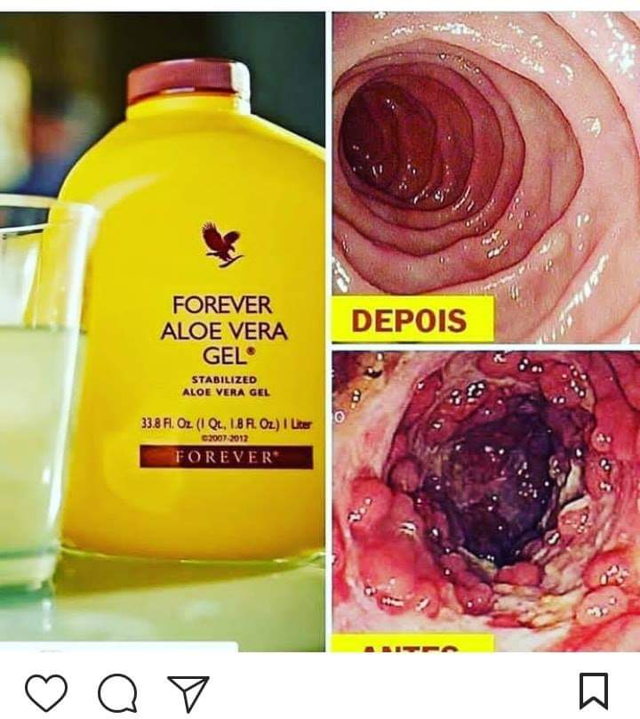 6 AMAZING BENEFITS OF ALOE VERA FOR DETOXIFYING YOUR DIGESTIVE SYSTEM