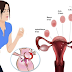 Natural Home Remedies For Menstrual Cramps That Actually Works