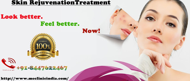  Laser Treatments For Skin Rejuvenation