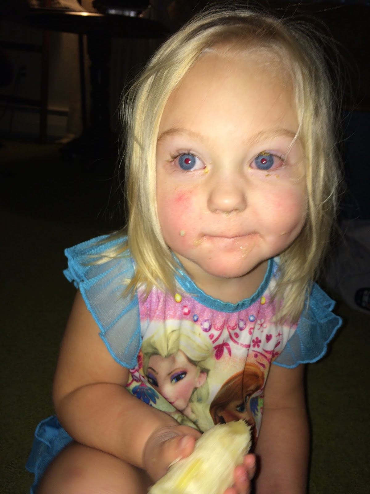 We Will Walk Forever Holding Hands Pink Eye Epidemic