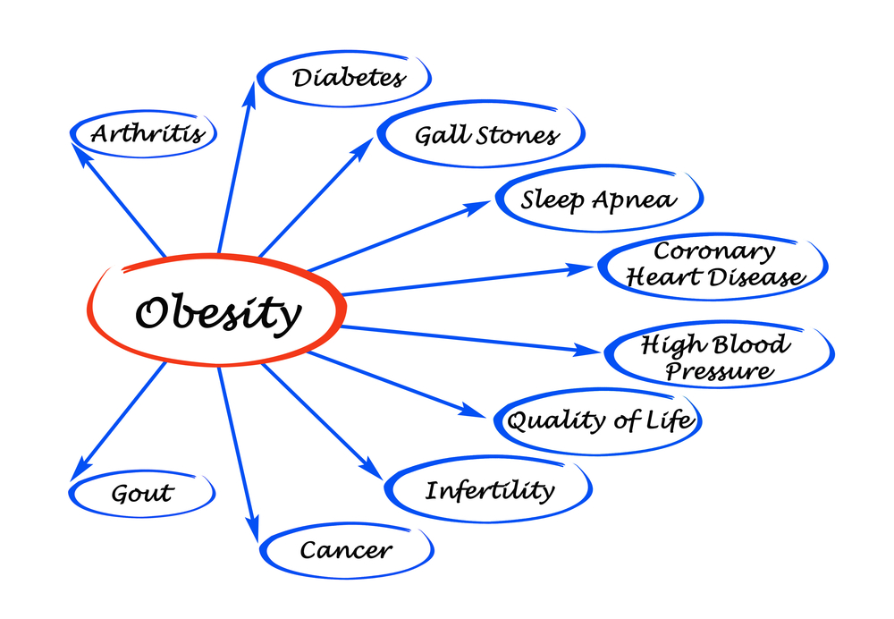 WHAT IS THE CAUSE OF OBESITY AND OVERWEIGHT?