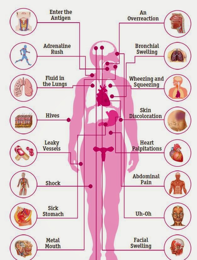 Allergic to Coconut? Homework BEFORE the Holidays avoiding ANAPHYLAXIS