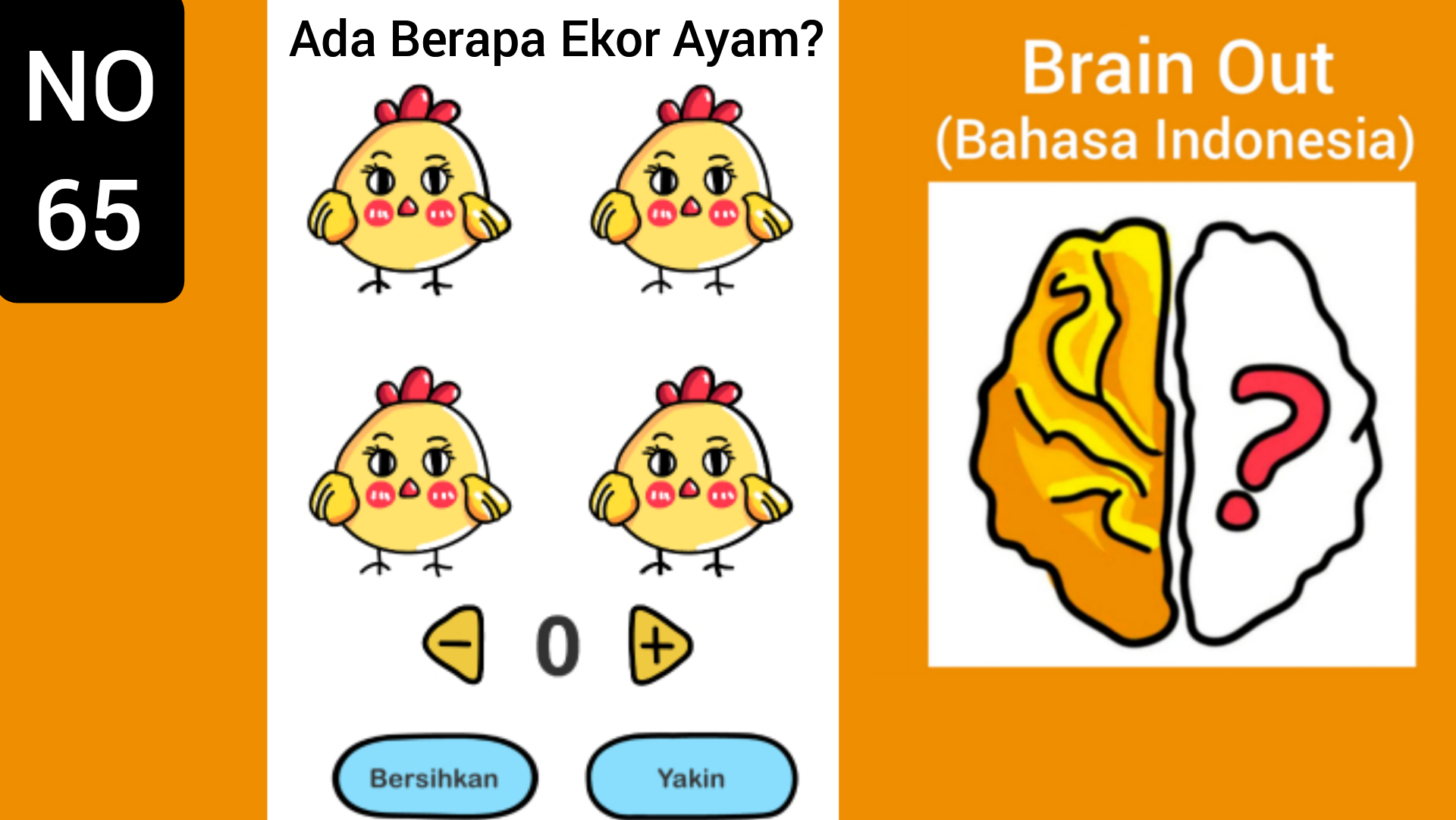 Brain 178