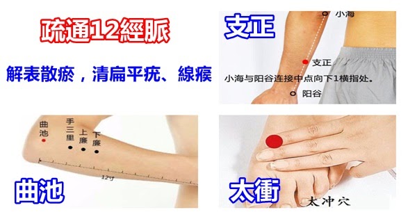 尋常疣中醫 