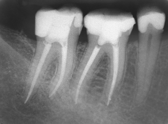 Terapia Endodontica – Centro Atopos - Foto 13