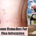 Top 5 Home Remedies for Fleas Infestation