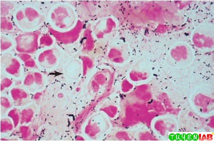 Trichomonas cocci