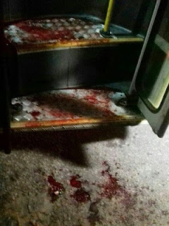 Esfaqueado no braço, motorista perdeu muito sangue (Foto: Wendell Jefferson)