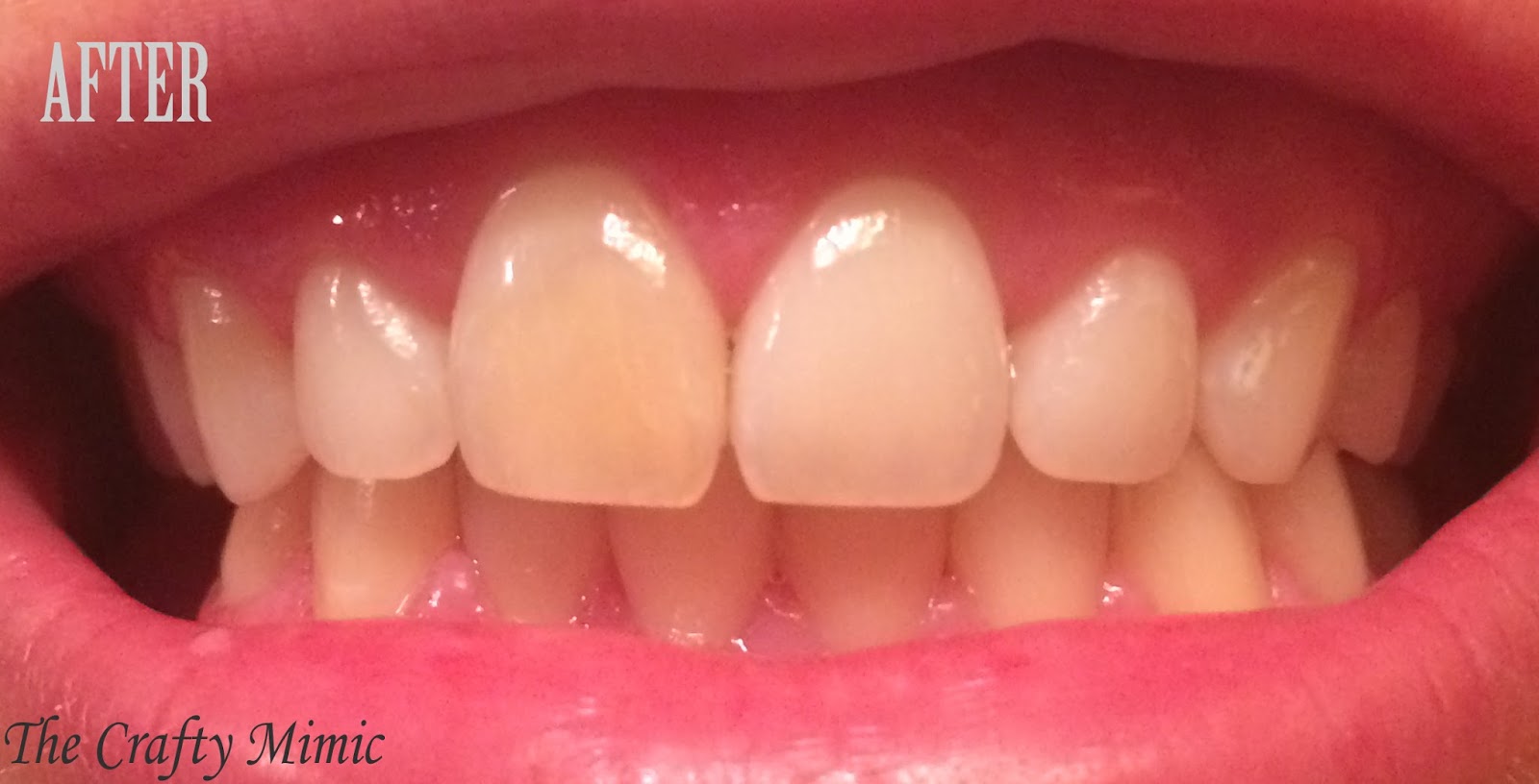 The Crafty Mimic Activated Charcoal Teeth Whitening