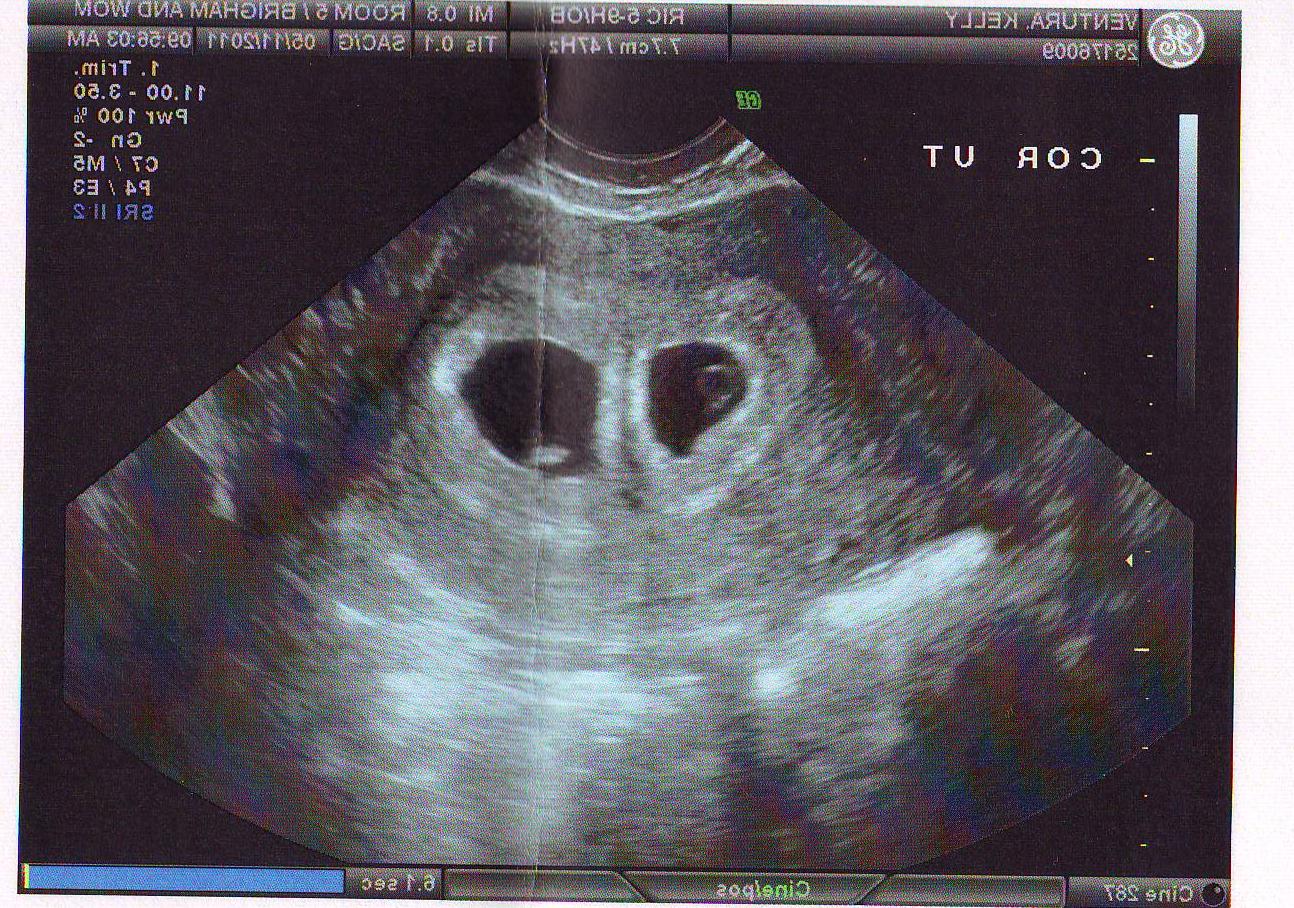 Twice the Fun in DC Grow Babies Grow!