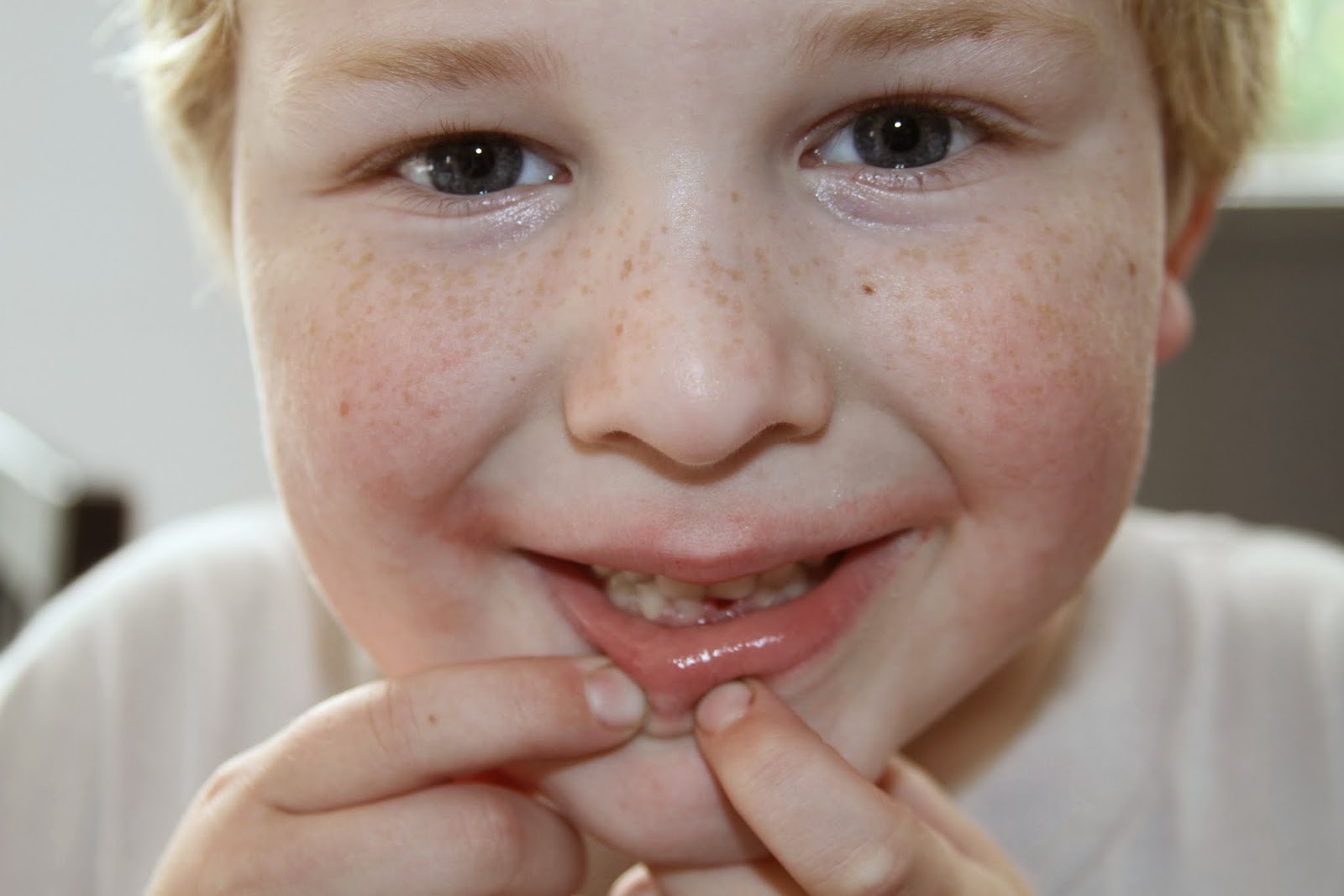 The Adventures of Noah J, Little Wy, and Annie Rose: His teeth are