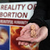 Cayetano bares: EU wants abortion, drug use legalized in exchange of aids