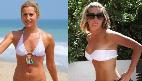 Sorry, that before and after pictures breast are Something is. before and after pictures breast think, that