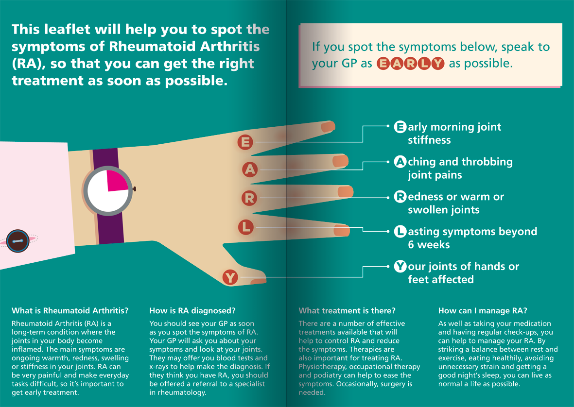 Rheumatoid Arthritis Symptoms Of The Hands Ear Jaw Pain * Arthritis