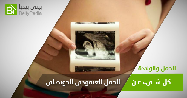 دبوس على الحمل