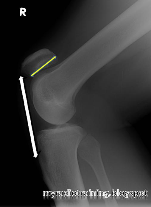 Radiology info hub Musculoskeletal