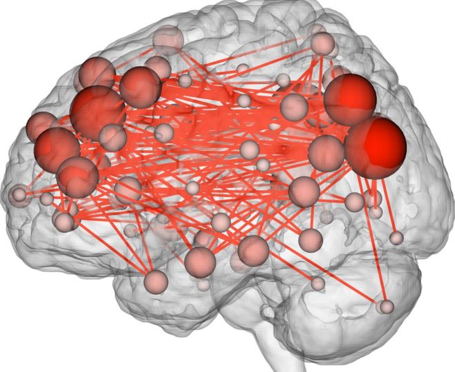 Brain's activity map makes stable 'fingerprint'