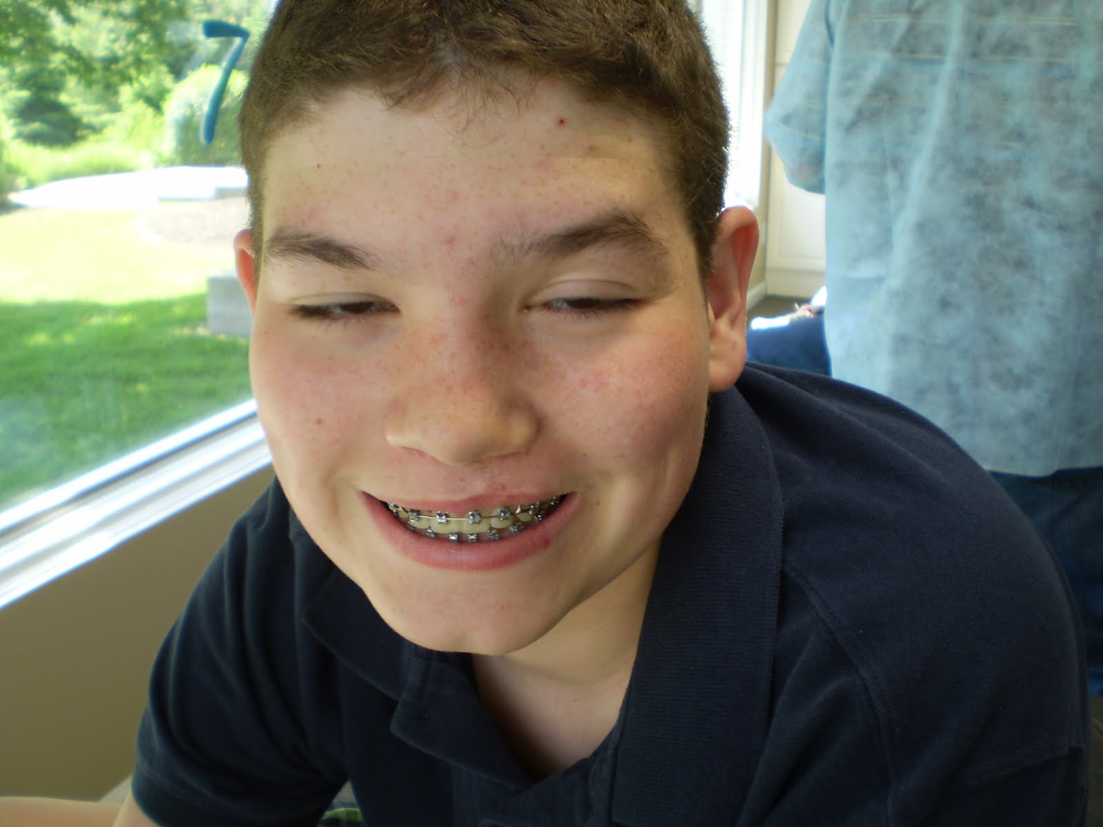 The Rellim Family Blogspot Braces Off again