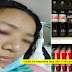 Attention: Girl's Whole Body Becomes Bloated After Drinking This Beverage Twice A Day