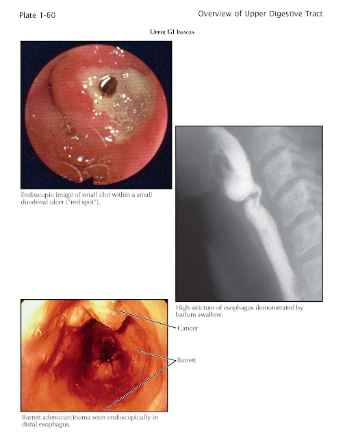 Overview of Imaging of the Upper Gastrointestinal Tract