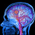 How To Train Your Brain To Stop Worrying and Thinking Negative Thoughts