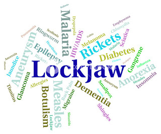 lockjaw-www.healthnote25.com