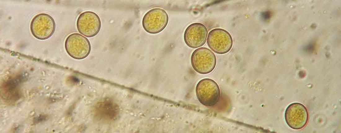 Pilobilus lentiger Pilobolus sphaerosporus spores